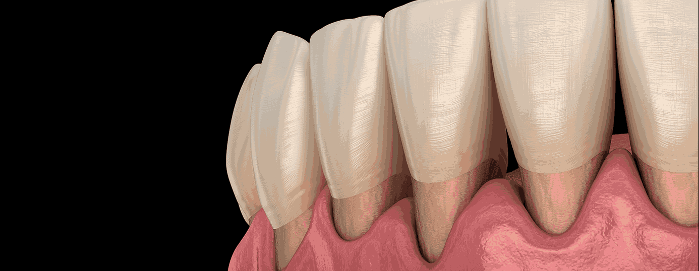 심미적인 치아의 3요소